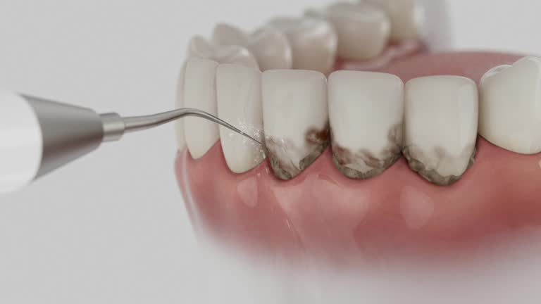 Trusted Teeth Cleaning And Checkup service in Statham, GA - Dentist Open Now